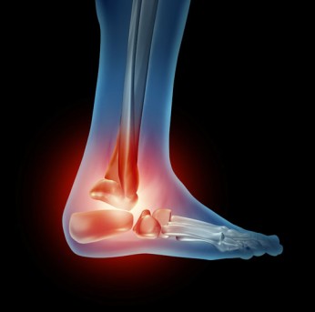 Ankle Arthrocentesis by OrangeCountySurgeons